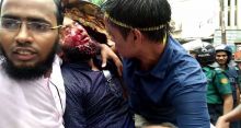 <font style='color:#000000'>Shahbag clash: Student loses both eyes</font>